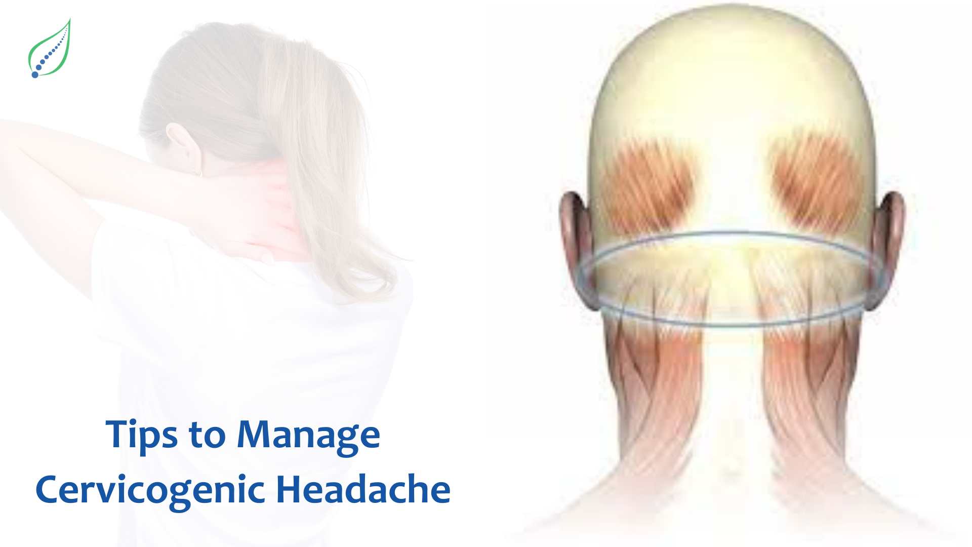 Tips to Manage Cervicogenic Headache